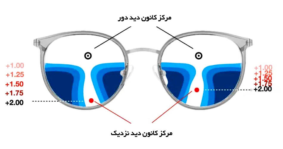 عینک تدریجی چیست و چرا در رشت محبوب شده است؟