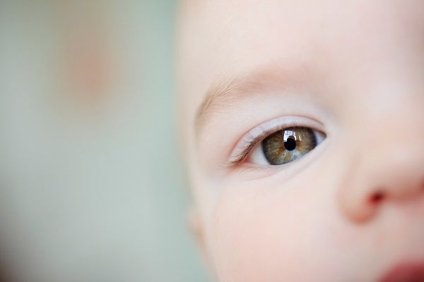 کم بینایی مادرزادی از جنینی تا تولد