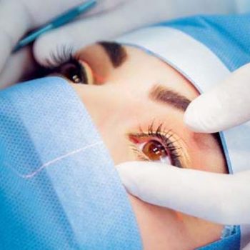 مراقبت های بعد از عمل کاشت لنز داخل چشمی