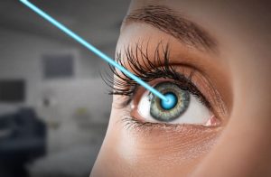 تفاوت عمل لیزیک چشم با دیگر جراحیهای چشم