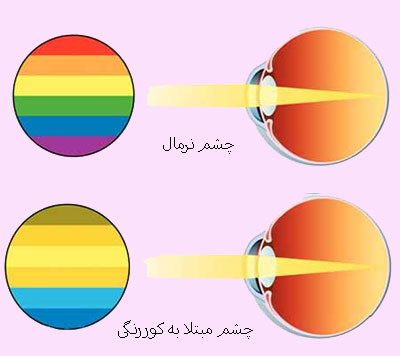 تست کور رنگی و شرح علائم کور رنگی