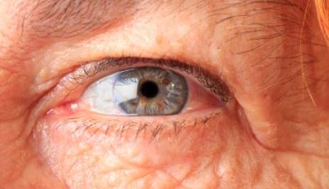 درمان تنبلی چشم در سنین بالا