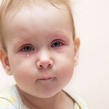 علائم آبریزش چشم