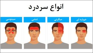 میگرن چشمی چیست؟