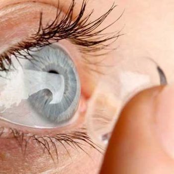 لنزهای اسکلرال برای آستیگماتیسم