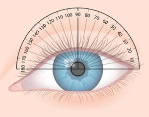 علل ایجاد آستیگماتیسم چیست؟