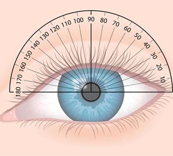 علل ایجاد آستیگماتیسم چیست؟