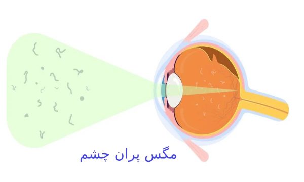 راهنمای جامع انتخاب بهترین عینک در رشت | عینک ساحل