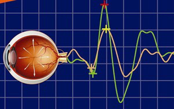 بررسی راه درمان ضعیف شدن عصب چشم