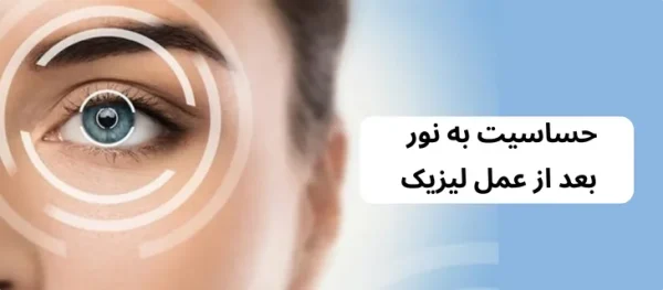 بررسی حساسیت به نور بعد از عمل لیزیک