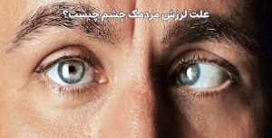 علت لرزش مردمک چشم چیست؟