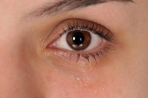 بهترین روش نگهداری از چشم های خشک و آسیب پذیر
